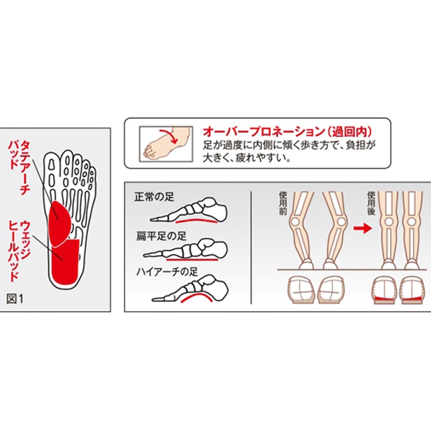 ソルボアーチウェッジヒールサポーター　薄型　Ｓ